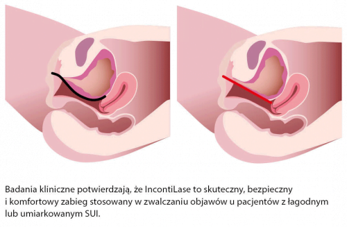 ginekologia-1-500x327