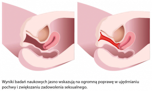 ginekologia-2-500x301